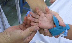 Bác sĩ chuyên khoa mách mẹ cách chăm trẻ mắc tay chân miệng và dấu hiệu cảnh báo nặng